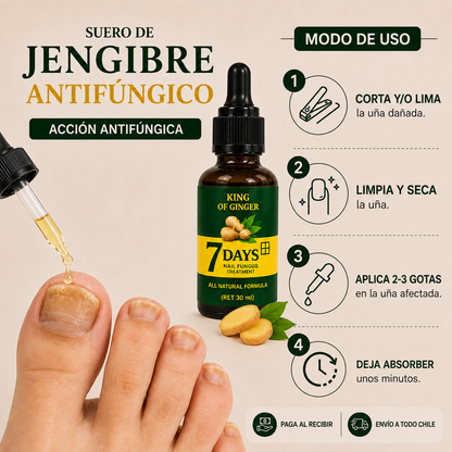 Suero de Jengibre Antifúngico para Uñas