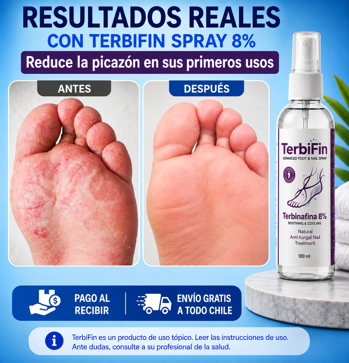 TerbiFin 8% Spray fungicida  Pies